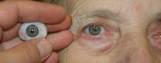 bioeye-detail