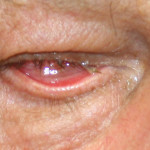 bioeye-aesthetic-parts-manufacture