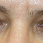 bioeye-result